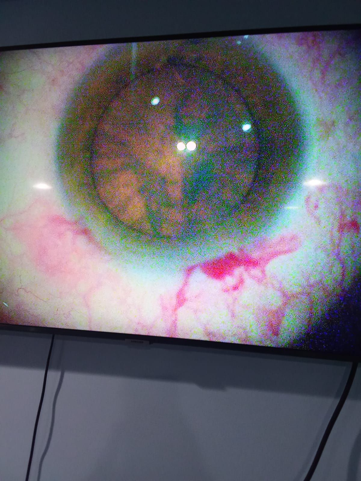 Corneal mapping and measurement equipment